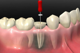 Endodontia (canal)