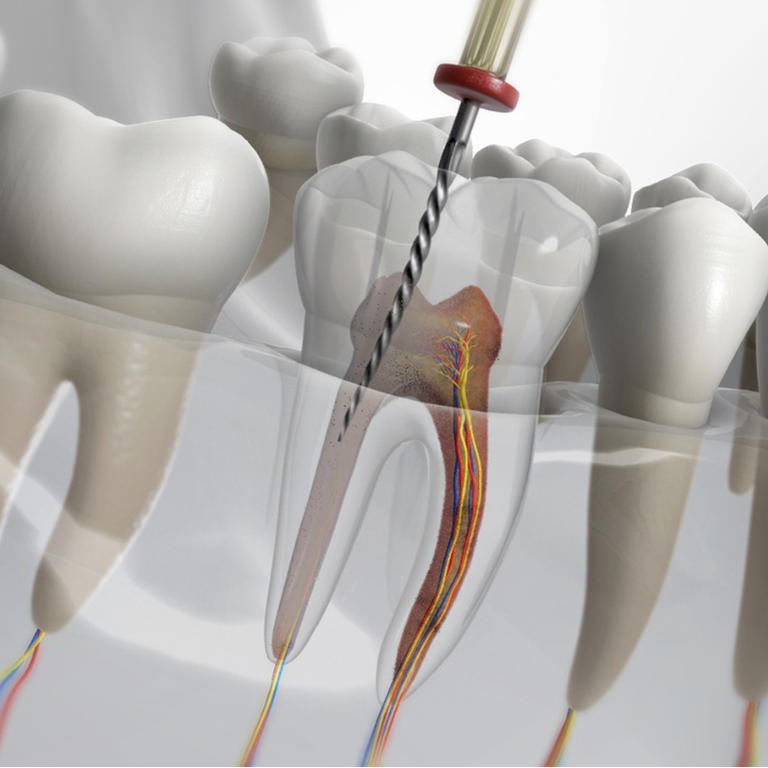 Endodontia